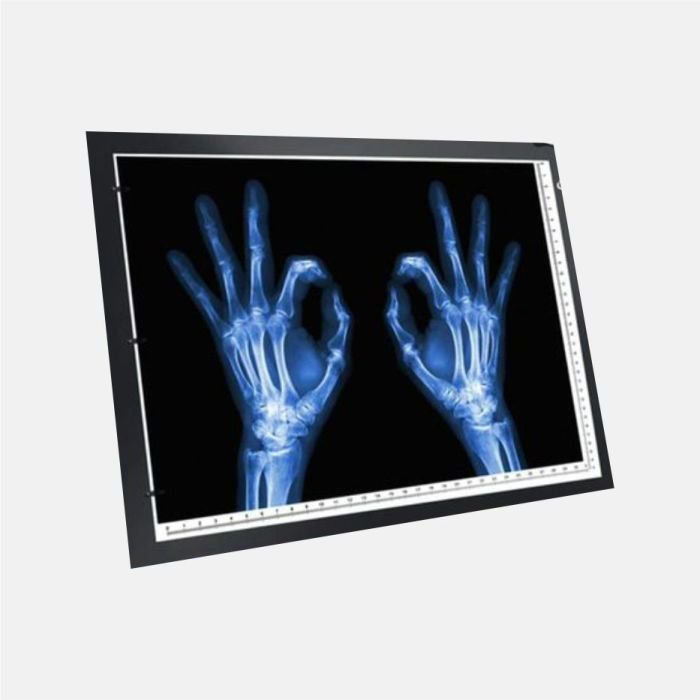X-ray Led